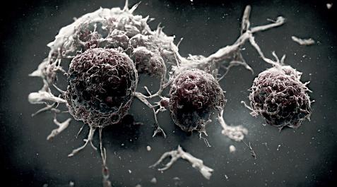 CANCER La mortalidad que produce el cáncer de pulmón es prácticamente equivalente a la suma de muertes causada por el cáncer de colon, mama y próstata juntos