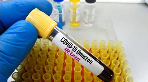 COVID-KRAKEN Han aparecido dos variantes predominantes de ómicron: la B.F.7 y la XBB.1.5, a la que algunos denominan ‘Kraken’