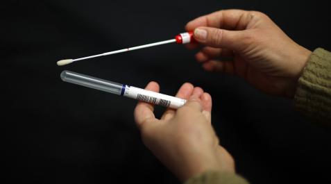Imagen del hisopo que se introduce en la vagina para tomar la muestra y el tubo que lo protege Imagen del hisopo que se introduce en la vagina para tomar la muestra y el tubo que lo protege