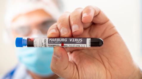 Virus-Marburgo El virus de Marburgo es un virus de ARN altamente patógeno que pertenece al orden Mononegavirales y, al igual que el virus del ébol