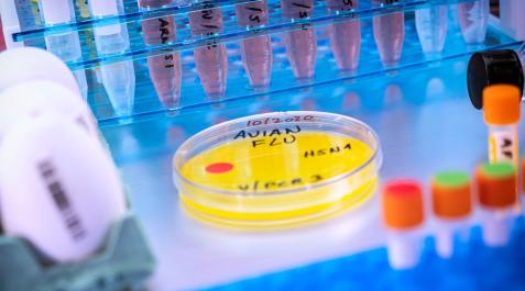 virus-gripe-aviar Para que el virus de la gripe aviar H5N1 acabase siendo pandémico debería mejorar su capacidad para transmitirse por vía aérea entre mamíferos y ser capaz de evadir el sistema inmunitario humano