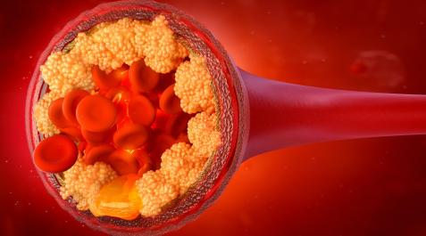 COLESTEROL El colesterol es un lípido (grasa) presente en todas las células del cuerpo e indispensable para el organismo