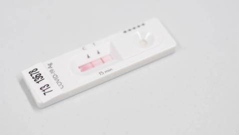 Un test de antígenos con resultado positivo Un test de antígenos con resultado positivo