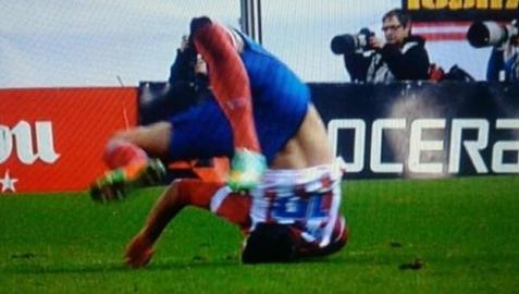 Manquillo sufre una fractura de lámina en una vértebra