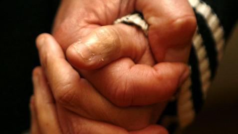 Crean un test que detecta el alzheimer en la sangre