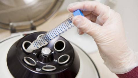 30 mujeres congelan sus óvulos cada año porque han sido diagnosticadas de cáncer