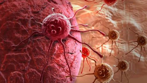 Células tumorales y de cáncer