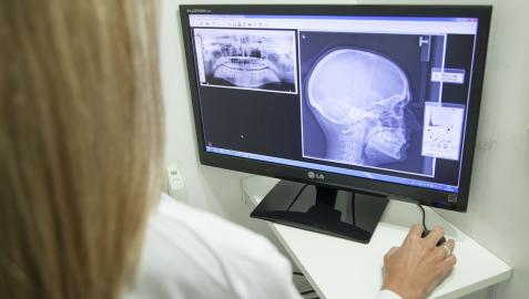 Un médico observa una radiografía