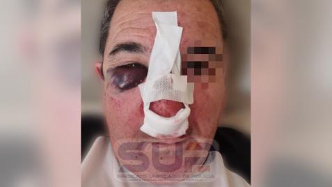 Imagen del agredido en Zaragoza