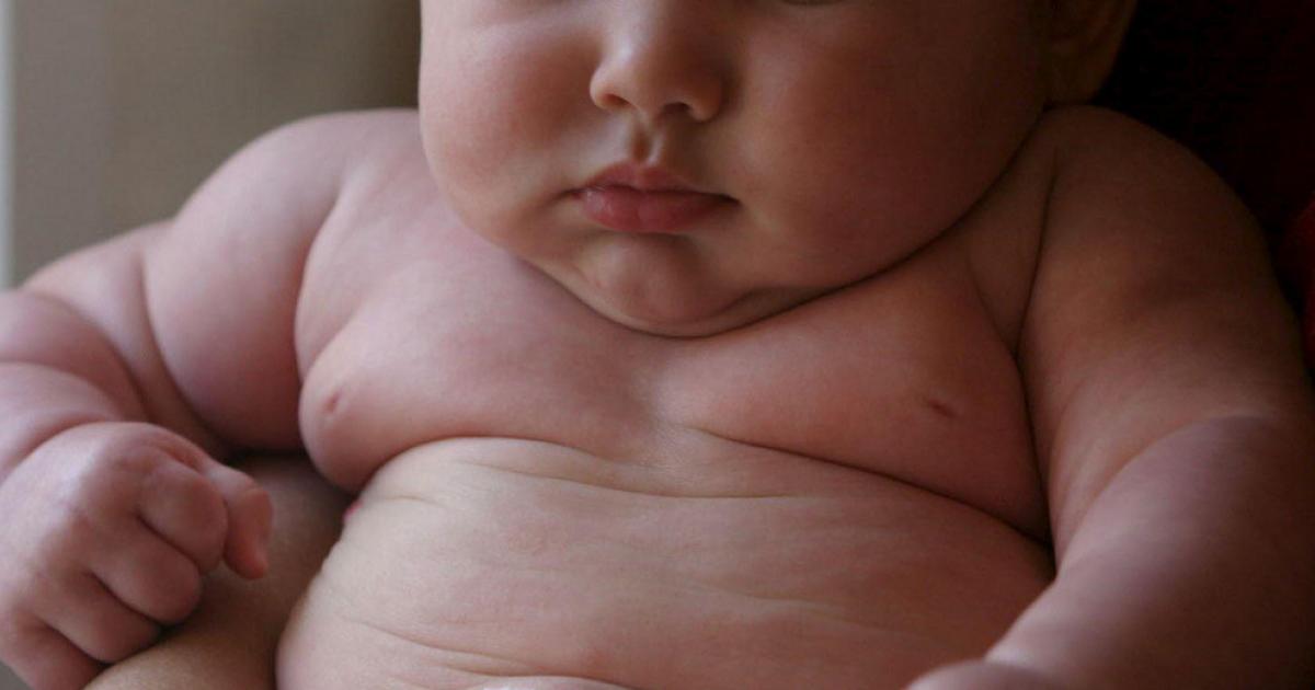 El índice de obesidad infantil supera por primera vez al de bajo peso a nivel mundial