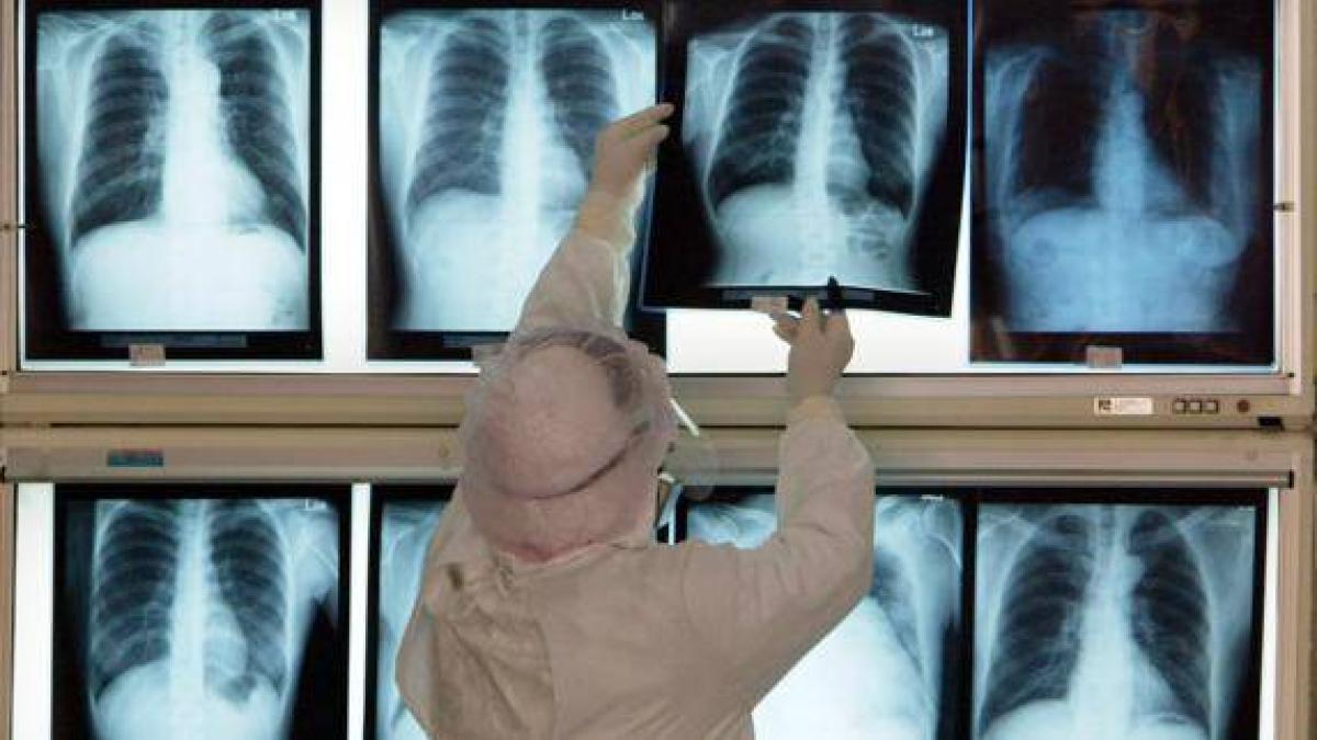 <![CDATA[Mejorar la higiene bucal reduce a más de la mitad el riesgo de neumonía intrahospitalaria]]>