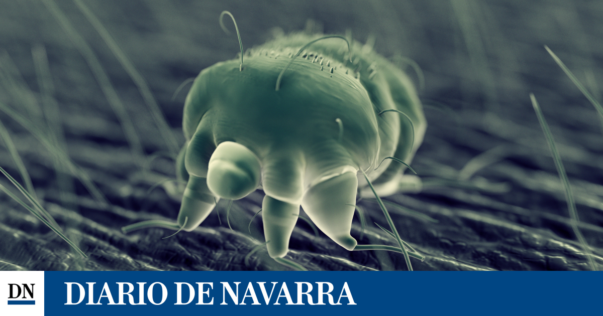 Sarna: Síntomas, diagnóstico y tratamiento. Clínica Universidad de Navarra