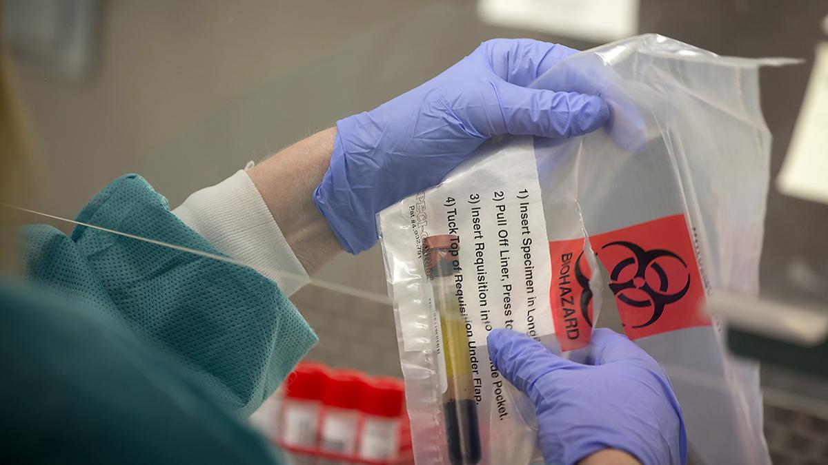 La OMS sigue de cerca el caso de una trabajadora de un laboratorio en ...