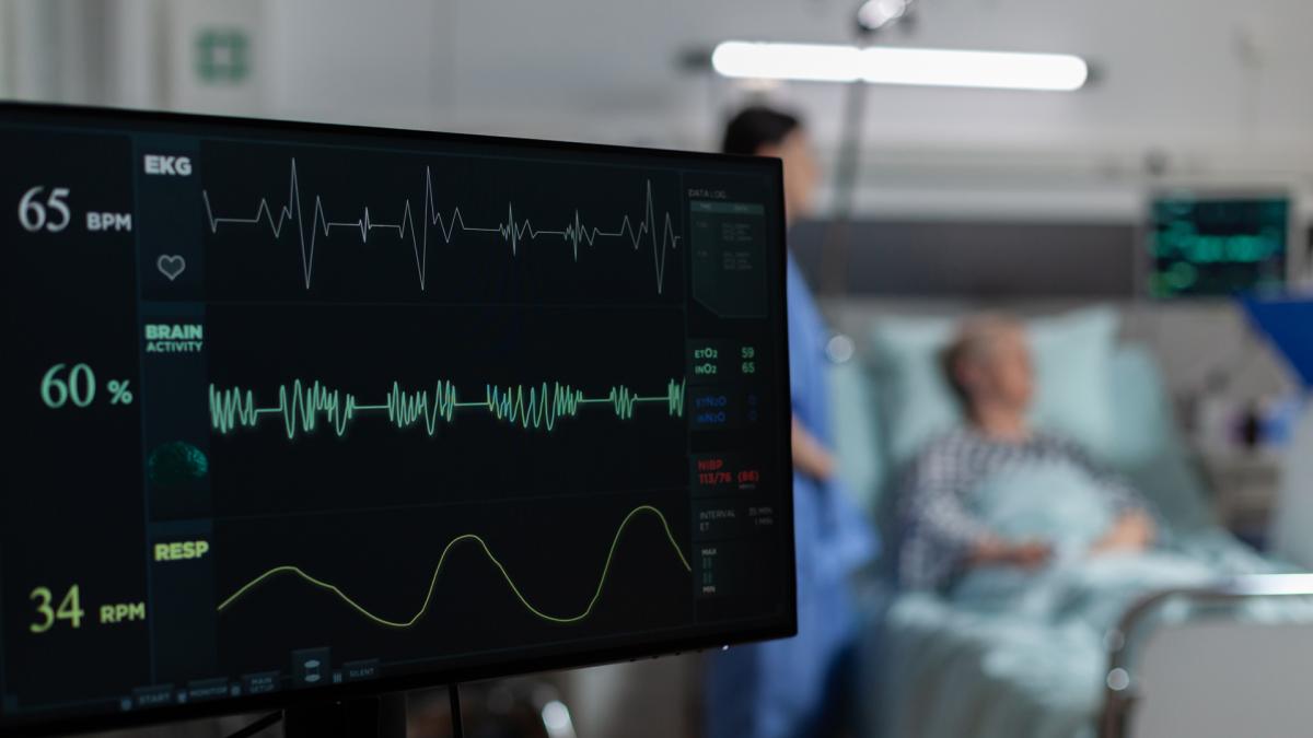 <![CDATA[Tanto la frecuencia cardíaca muy baja como la muy alta está asociada con el riesgo de sufrir un derrame cerebral]]>