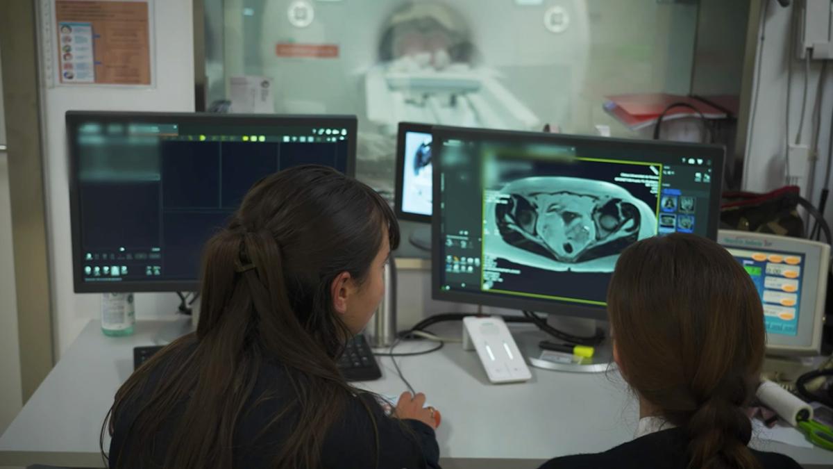 <![CDATA[Un programa del Cancer Center Clínica Universidad de Navarra permite que algunos pacientes con cáncer de recto puedan evitar la cirugía sin comprometer el control del tumor]]>