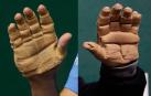 Las manos de Urrutikoetxea (izda.) y Bengoetxea (dcha.)