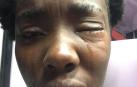 Las agresiones a extranjeros disparan "la alarma racismo" en Italia