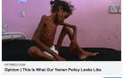 Facebook censura una foto del New York Times del hambre en Yemen por mostrar "desnudez"