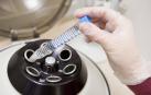 30 mujeres congelan sus óvulos cada año porque han sido diagnosticadas de cáncer