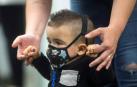 Un niño burbuja se cura gracias a ser diagnosticado con la prueba del talón