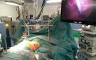Una intervención de “pectus excavatum” o “pecho hundido”.