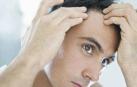El problema más habitual es la alopecia androgenética.