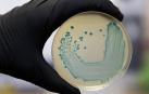 Imagen de un cultivo de la bacteria listeria.