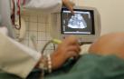 3 de cada 10 mujeres en tratamiento de fertilidad no tienen pareja