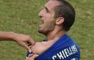 Abren expediente a Su&aacute;rez por su mordisco a Chiellini