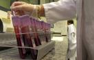 Un análisis de sangre para predecir enfermedades crónicas