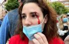 Herida de una pedrada una diputada de Vox en un mitin en Sestao