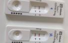 Navarra testea ya las nuevas pruebas para detectar el virus, con resultados en 15 minutos