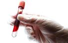 La biopsia líquida, la "revolución" que cambiará la forma de tratar el cáncer