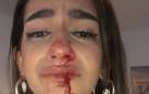Una joven pamplonesa denuncia una agresión tránsfoba en Barcelona