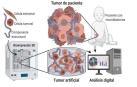 La impresión 3D ayuda al conocimiento de varios tipos de tumores