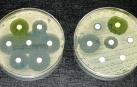 Bacterias resistentes a los antibióticos: un problema serio