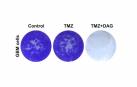 Hallan una terapia que mejoraría la supervivencia de pacientes con tumor cerebral