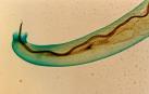Angiostrongylus cantonensis, gusano pulmonar de las ratas.