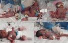 Las fotos compiladas, proporcionadas por el Hospital de la Universidad Nacional de Seúl
