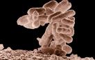 Micrografía electrónica de baja temperatura de un cúmulo de bacterias