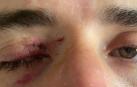 Así ha quedado el ojo de Karim Ansarifard