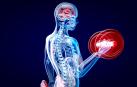 Una radiografía de un hombre haciendo pesas