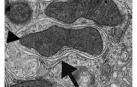 Imagen de microscopía electrónica de transmisión de una vesícula autofágica en el riñón de un ratón