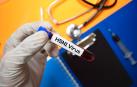 Virus H5N1