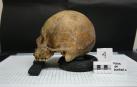 Imagen de archivo de un cráneo hallado en una investigación