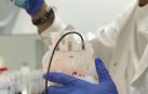 Investigadores desarrollan metodología para diagnóstico precoz de cáncer de mama con una sola muestra de sangre