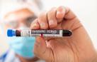 El virus de Marburgo es un virus de ARN altamente patógeno que pertenece al orden Mononegavirales y, al igual que el virus del ébol