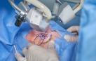 Una persona se somete a una operación de ojos