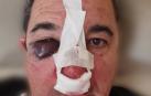 Imagen del agente agredido en Zaragoza