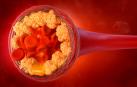 El colesterol es un lípido (grasa) presente en todas las células del cuerpo e indispensable para el organismo